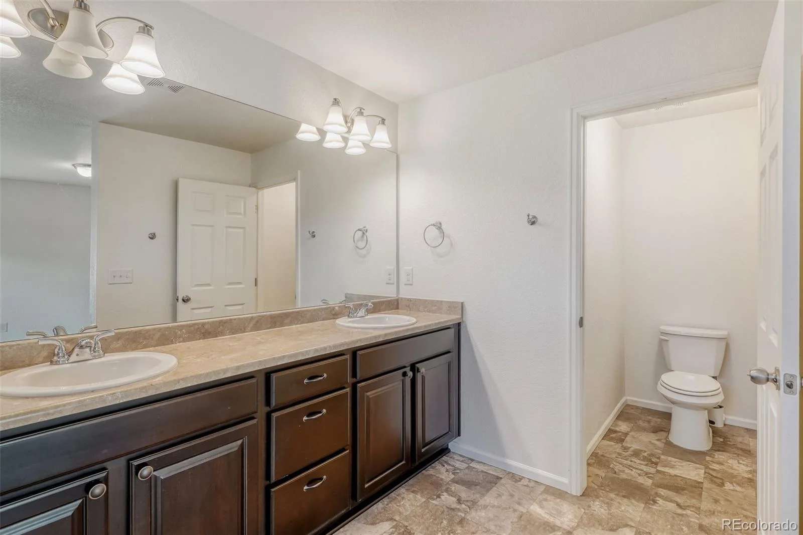 19001 E 55Th Avenue Denver CO 80249 | MLS #REC8067852 07092026155208 1600 21