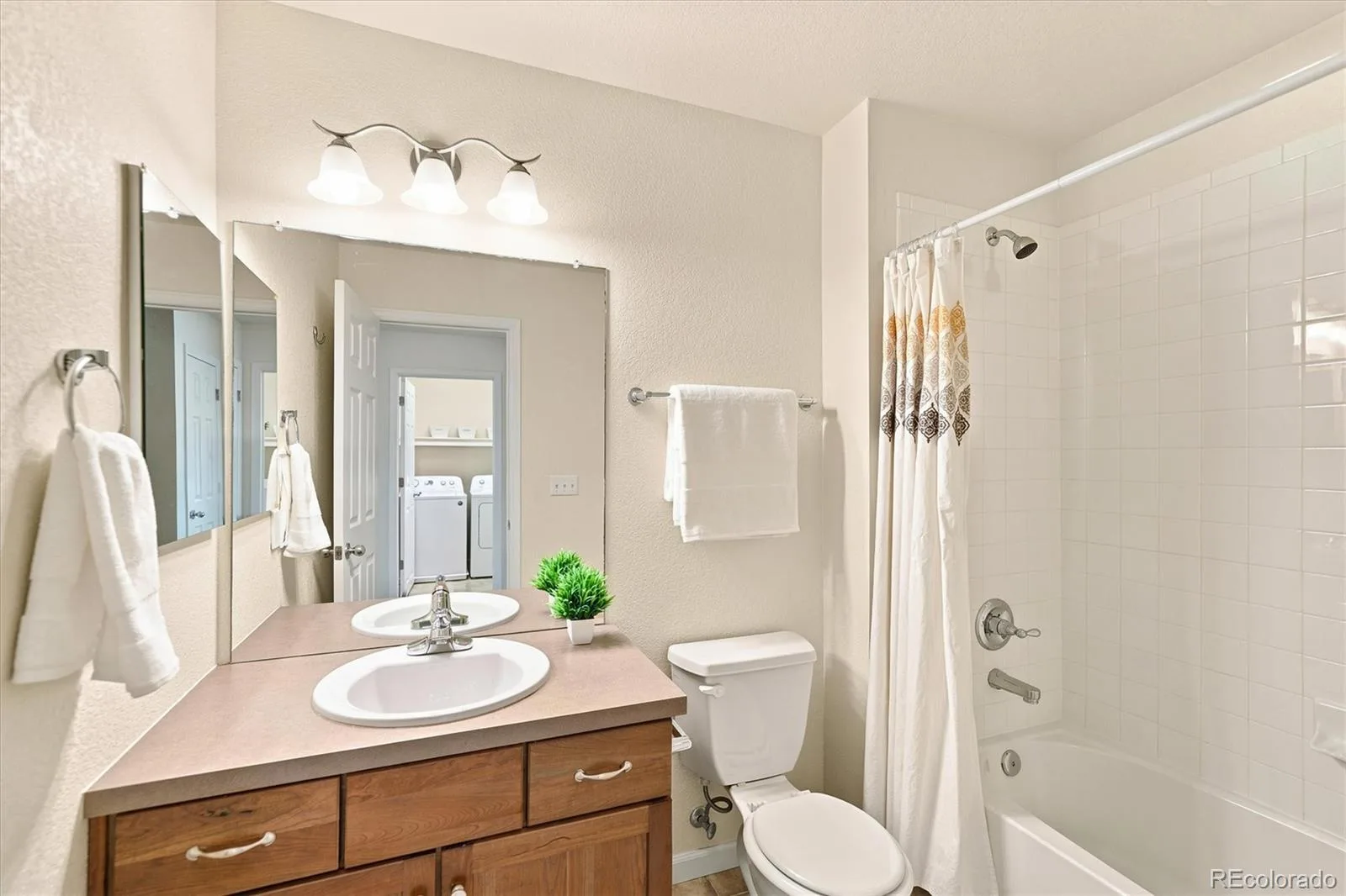 8705 E 29th Place Denver CO 80238 | MLS #REC9402527 08032026224622 1600 28